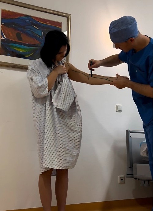 Lipödem Heldin Jule vor ihrer Liposuktion an den Armen